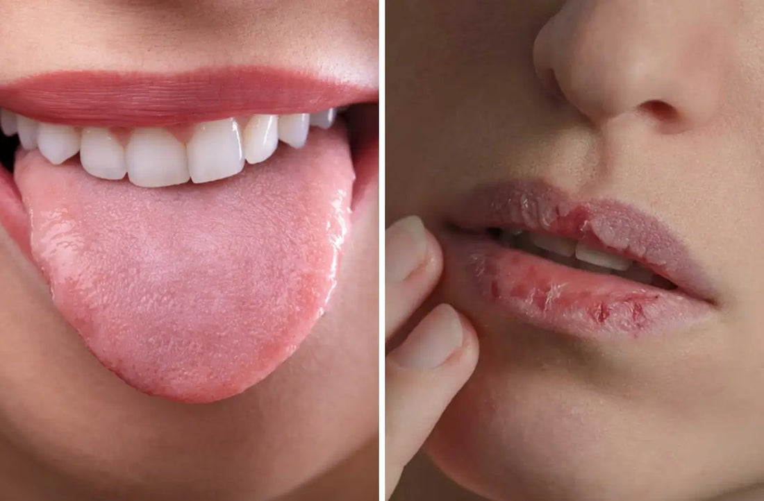 CPAP Dry Mouth: What's The Solution?