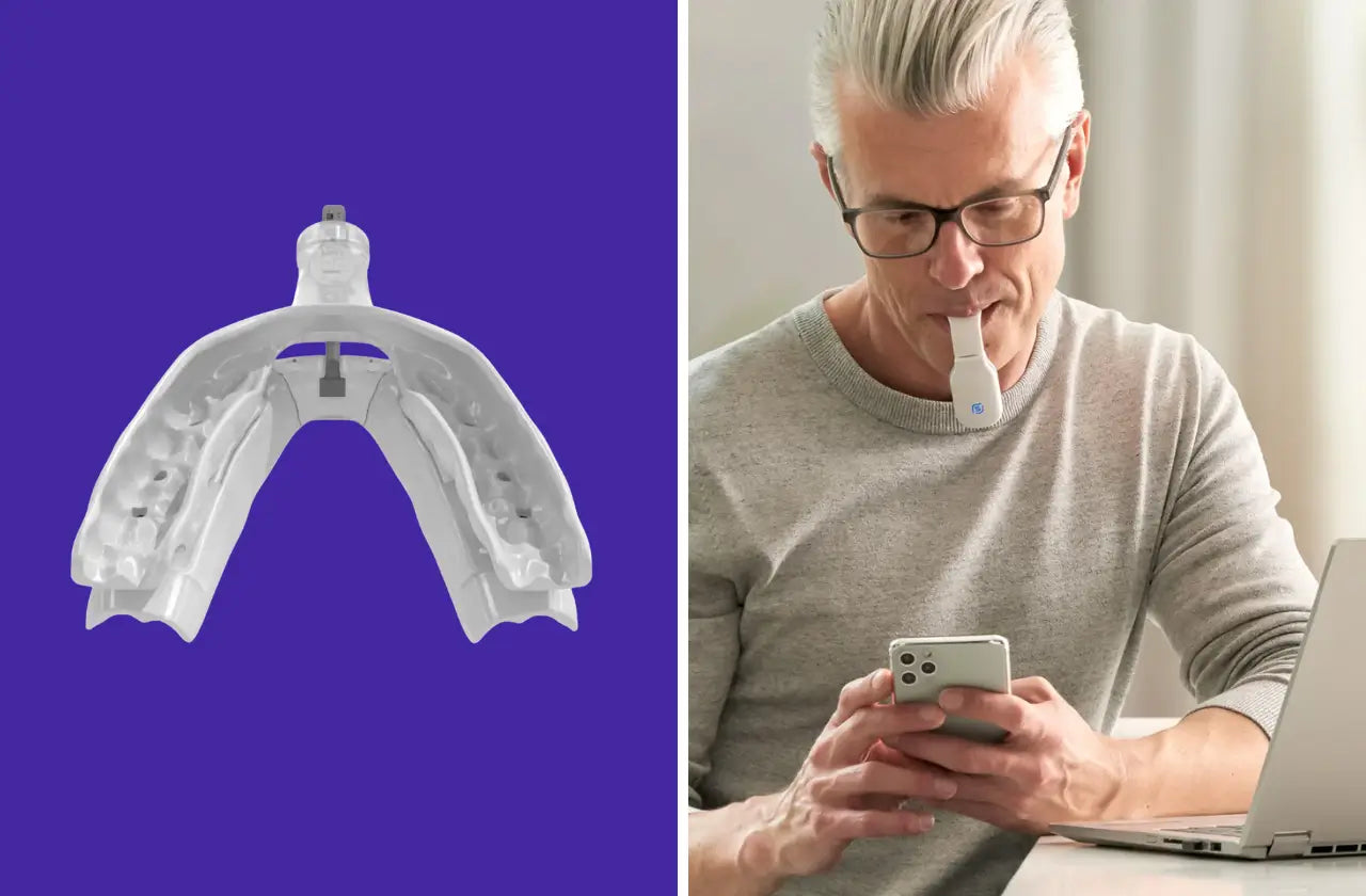 Oral appliances for sleep apnea