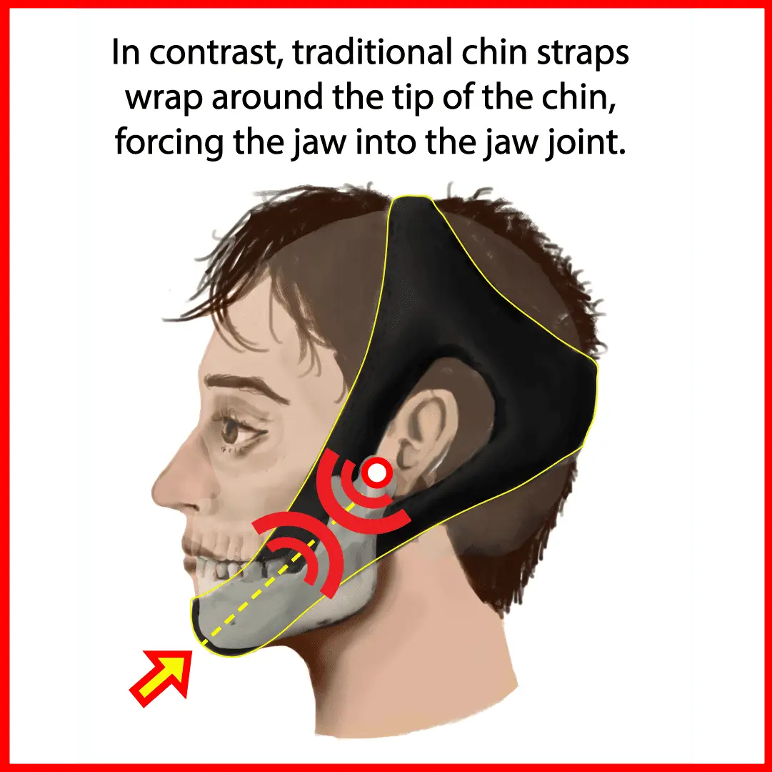 Chin Strap Jaw Bone