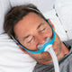 Man sleeping with Evora nasal mask.