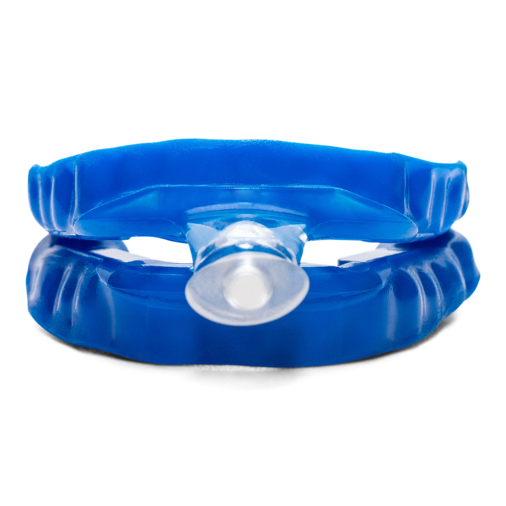 flexTAP Custom Oral Appliance from front