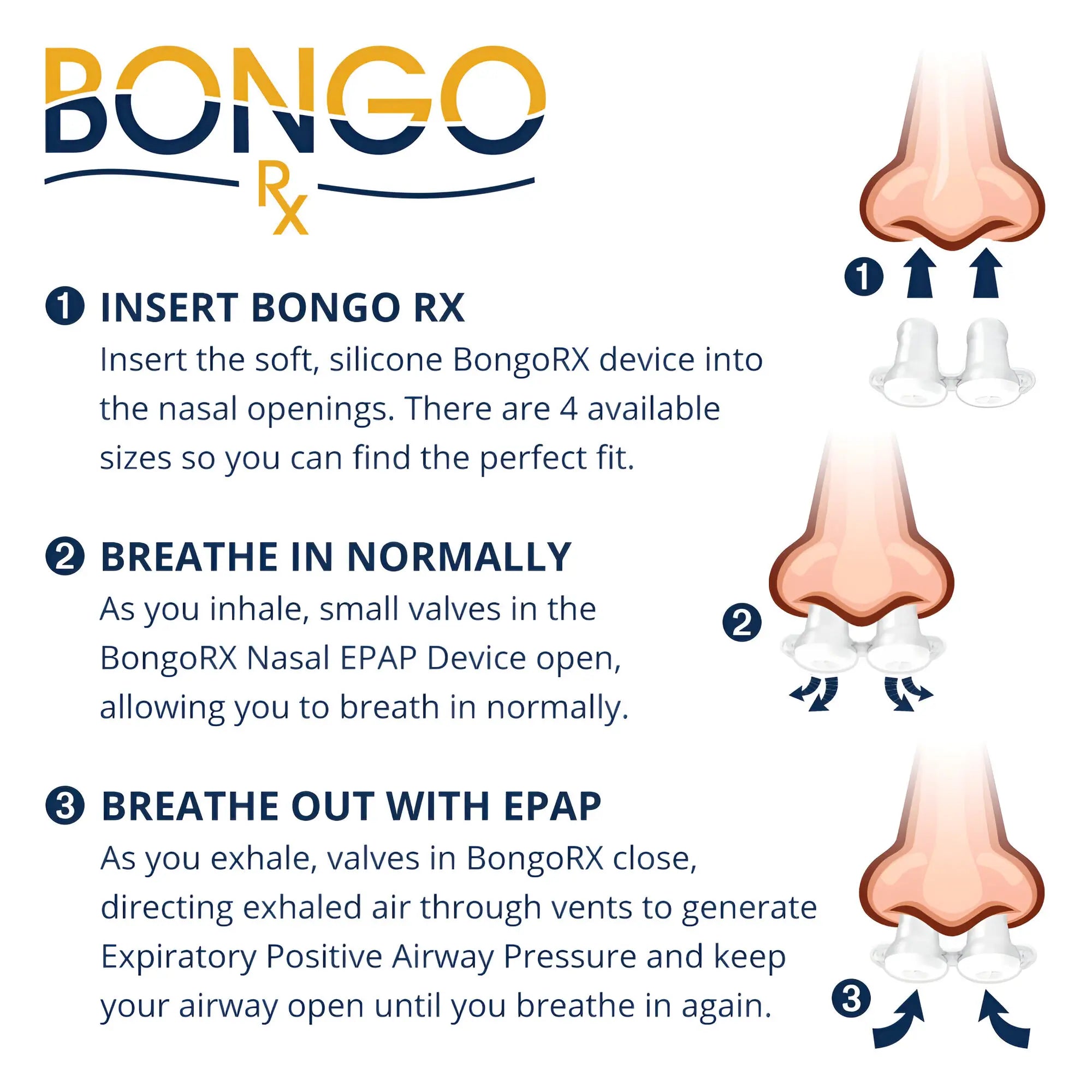 how to use the Bongo RX for Sleep Apnea Therapy